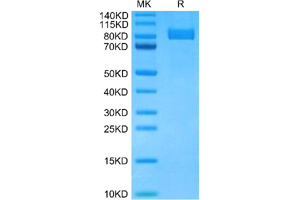 MME Protein (AA 53-750) (His tag)