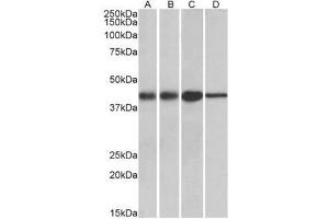 Western blot analysis: ACAT1 antibody staining of Mouse (A) and Rat (B) kidney lysates, and Mouse (C) and Rat (D) Liver lysates at 0. (ACAT1 抗体  (Internal Region))