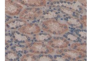Detection of GAL8 in Human Kidney Tissue using Polyclonal Antibody to Galectin 8 (GAL8) (LGALS8 抗体  (AA 1-317))