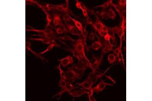 ABIN6266860 staining HeLa by IF/ICC. (Ephrin A5 抗体  (Internal Region))