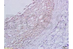 Formalin-fixed paraffin embedded rat ovary tissue labeled with Anti-ADRB1 Polyclonal Antibody, Unconjugated (ABIN669351) at 1:200 followed by conjugation to the secondary antibody and DAB staining (ADRB1 抗体  (AA 181-250))