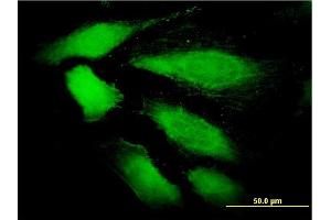 Immunofluorescence (IF) image for anti-ArfGAP with SH3 Domain, Ankyrin Repeat and PH Domain 1 (ASAP1) (AA 1030-1129) antibody (ABIN565496)