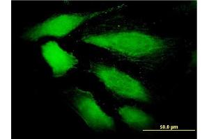 Immunofluorescence of monoclonal antibody to DDEF1 on HeLa cell. (ASAP1 抗体  (AA 1030-1129))