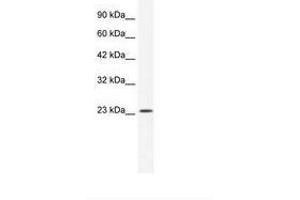 Image no. 1 for anti-Potassium Channel Tetramerisation Domain Containing 11 (KCTD11) (AA 61-110) antibody (ABIN202099)