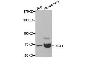 Western blot analysis of extracts of various cell lines, using CHAT antibody. (Choline Acetyltransferase 抗体  (AA 331-630))