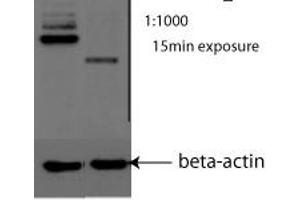 PML antibody - N-terminal region  validated by WB using Neuroblastoma at 1:1000. (PML 抗体  (N-Term))