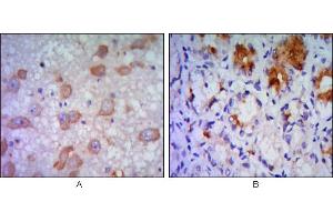 Immunohistochemical analysis of paraffin-embedded human brain tissue (A) and stomach tissue (B), showing cytoplasmic localization using ERN1 mouse mAb with DAB staining. (ERN1 抗体)