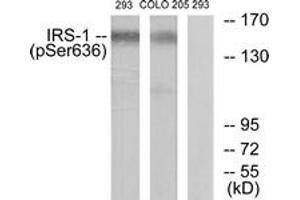 Western blot analysis of extracts from 293 cells and COLO205 cells, using IRS-1 (Phospho-Ser636) Antibody.
