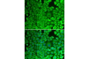 Immunofluorescence (IF) image for anti-Glycogen Synthase 1 (Muscle) (GYS1) antibody (ABIN1872925) (Glycogen Synthase 1 抗体)