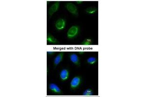 ICC/IF Image Immunofluorescence analysis of paraformaldehyde-fixed HeLa, using Laminin beta-1, antibody at 1:100 dilution. (Laminin beta 1 抗体  (C-Term))