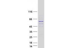 Western Blotting (WB) image for Spermatogenesis and Oogenesis Specific Basic Helix-Loop-Helix 2 (SOHLH2) protein (Myc-DYKDDDDK Tag) (ABIN2732348)
