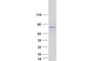 Validation with Western Blot (SOHLH2 Protein (Myc-DYKDDDDK Tag))