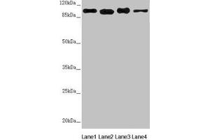 Western blot All lanes: DHTKD1 antibody at 1. (DHTKD1 抗体  (AA 1-280))