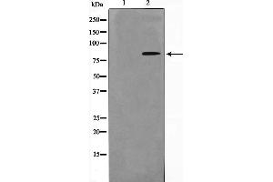 Western blot analysis on HuvEc cell lysate using Phospho-Nibrin(Ser278) Antibody，The lane on the left is treated with the antigen-specific peptide. (Nibrin 抗体  (pSer278))