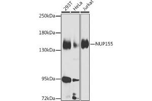 Western blot analysis of extracts of various cell lines, using NUP155 Antibody (ABIN6128363, ABIN6144953, ABIN6144954 and ABIN6223714) at 1:1000 dilution. (NUP155 抗体  (AA 1102-1391))