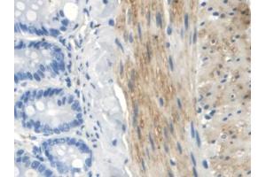 DAB staining on IHC-P; Samples: Rat Small intestine Tissue (TLR5 抗体  (AA 325-644))