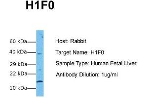Host: Rabbit Target Name: H1F0 Sample Tissue: Human Fetal Liver Antibody Dilution: 1. (Histone H1 抗体  (N-Term))