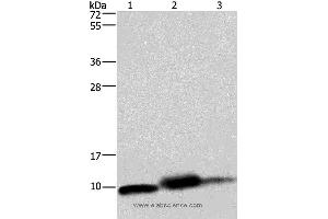 Western blot analysis of Mouse heart, human fetal liver and hepatocellular carcinoma tissue,, using COX6B1 Polyclonal Antibody at dilution of 1:1150 (COX6B1 抗体)