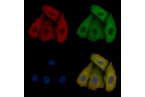 TUSC1 Mouse Monoclonal Antibody staining Hela cells by IF/ICC. (TUSC1 抗体)