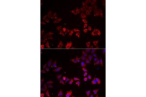 Immunofluorescence analysis of A549 cells using LIMS1 antibody (ABIN6293172). (LIMS1 抗体)