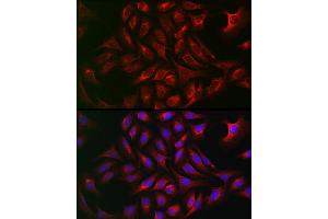 Immunofluorescence analysis of U2OS cells using  Rabbit pAb (ABIN7265789) at dilution of 1:50 (40x lens). (ATG12 抗体  (AA 1-74))
