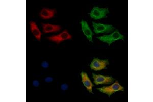 ABIN7093853 and ABIN7097896 staining HepG2 cells by IF/ICC.