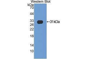 Western blot analysis of the recombinant protein. (ACTN2 抗体  (AA 1-254))