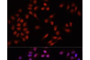 Immunofluorescence analysis of HeLa cells using PRDM14 Polyclonal Antibody at dilution of 1:100. (PRDM14 抗体)