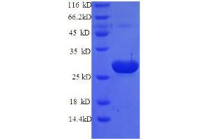 SDS-PAGE (SDS) image for Tumor Protein, Translationally-Controlled 1 (TPT1) (AA 1-172), (full length) protein (His tag) (ABIN5713906)