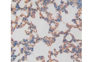 Used in DAB staining on fromalin fixed paraffin- embedded lung tissue (TIE1 抗体  (AA 435-609))