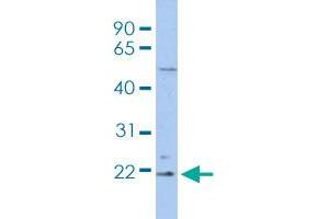 Western blot analysis of THP-1 cell lysate with RBBP9 polyclonal antibody . (RBBP9 抗体  (AA 1-50))