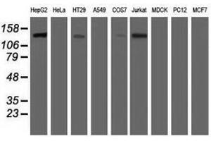 Image no. 2 for anti-Histone Deacetylase 6 (HDAC6) antibody (ABIN1498618) (HDAC6 抗体)