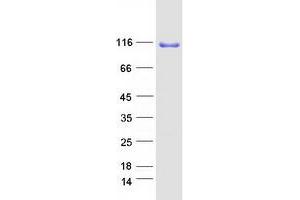 Western Blotting (WB) image for O-Linked N-Acetylglucosamine (GlcNAc) Transferase (UDP-N-Acetylglucosamine:polypeptide-N-Acetylglucosaminyl Transferase) (OGT) (Transcript Variant 1) protein (Myc-DYKDDDDK Tag) (ABIN2727888)