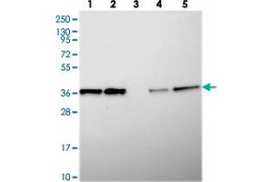 Western blot analysis of Lane 1: RT-4, Lane 2: U-251 MG, Lane 3: Human Plasma, Lane 4: Liver, Lane 5: Tonsil with CHORDC1 polyclonal antibody  at 1:250-1:500 dilution. (CHORDC1 抗体)
