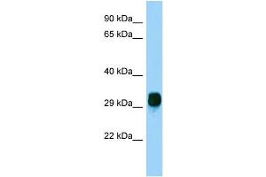 Host: Rabbit Target Name: FBXO17 Sample Type: HepG2 Whole Cell lysates Antibody Dilution: 1. (FBXO17 抗体  (N-Term))