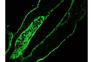 Image no. 1 for anti-pan Keratin (panKRT) antibody (ABIN959483) (pan Keratin 抗体)