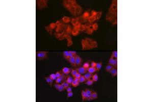 Immunofluorescence analysis of HepG2 cells using CFTR Rabbit pAb (ABIN6129855, ABIN6138469, ABIN6138470 and ABIN6224429) at dilution of 1:150 (40x lens). (CFTR 抗体  (AA 1161-1480))
