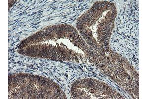 Image no. 2 for anti-Myeloid Leukemia Factor 1 (MLF1) antibody (ABIN1499496) (MLF1 抗体)