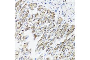 Immunohistochemistry of paraffin-embedded mouse stomach using TIMM10B antibody at dilution of 1:100 (x40 lens). (TIMM10B 抗体)