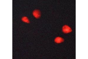 ABIN6269054 staining MCF-7 cells by ICC/IF. (HDAC3 抗体  (C-Term))