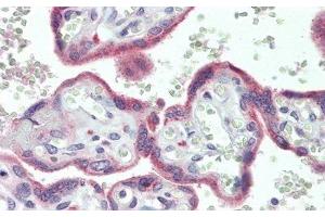 Detection of PLA2R1 in Human Placenta Tissue using Polyclonal Antibody to Phospholipase A2 Receptor 1 (PLA2R1)