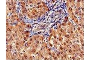 Immunohistochemistry (IHC) image for anti-Arginase, Liver (ARG1) (AA 1-322) antibody (ABIN6091459) (Liver Arginase 抗体  (AA 1-322))