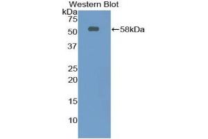 Detection of Recombinant Ntn1, Rat using Polyclonal Antibody to Netrin 1 (Ntn1) (Netrin 1 抗体  (AA 313-565))