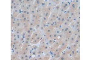IHC-P analysis of Human Tissue, with DAB staining. (NPEPPS 抗体  (AA 141-272))