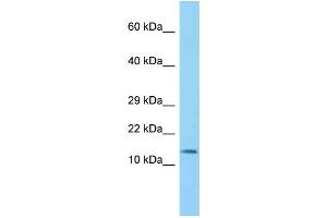 WB Suggested Anti-Bloc1s2 Antibody Titration: 1. (BLOC1S2 抗体  (N-Term))