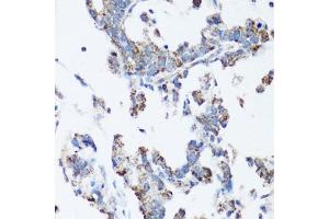 Immunohistochemistry (IHC) image for anti-Proto-oncogene tyrosine-protein kinase Src (Src) (AA 1-80) antibody (ABIN6148428)
