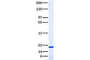 Validation with Western Blot (TNFRSF11A 蛋白)