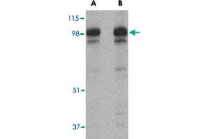 Western blot analysis of SLITRK2 in rat brain tissue lysate with SLITRK2 polyclonal antibody  at (A) 1 and (B) 2 ug/mL . (SLITRK2 抗体  (C-Term))