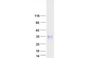 Validation with Western Blot