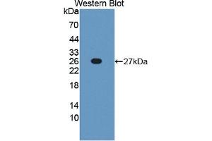 Detection of Recombinant TNFSF9, Mouse using Polyclonal Antibody to Tumor Necrosis Factor Ligand Superfamily, Member 9 (TNFSF9) (TNFSF9 抗体  (AA 105-309))